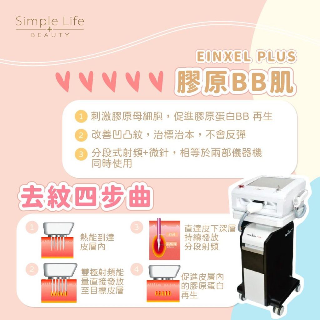 妊娠消除去紋的4大步驟